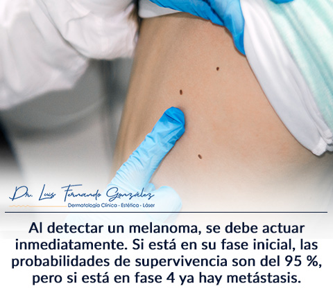 23 de Mayo: Da Mundial del Melanoma, en una Evaluacin Mdica.