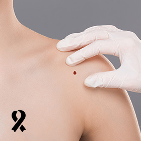 23 de Mayo: Da Mundial del Melanoma.