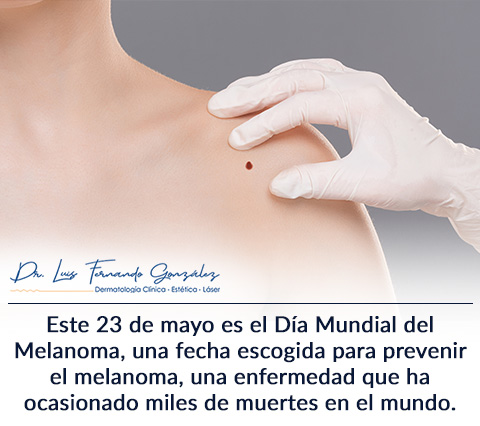 23 de Mayo: Da Mundial del Melanoma.