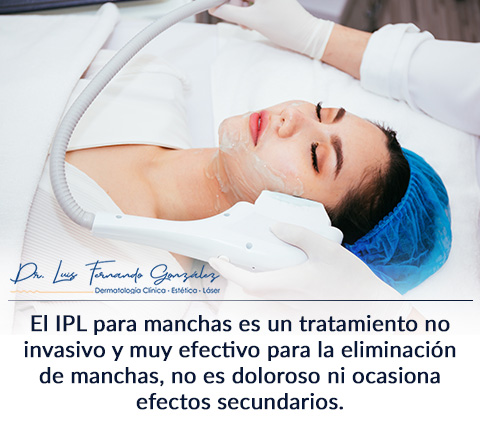 Eliminacin de Manchas con Tratamiento IPL