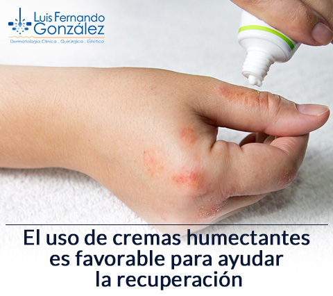 Dermatitis Atpica Cremas