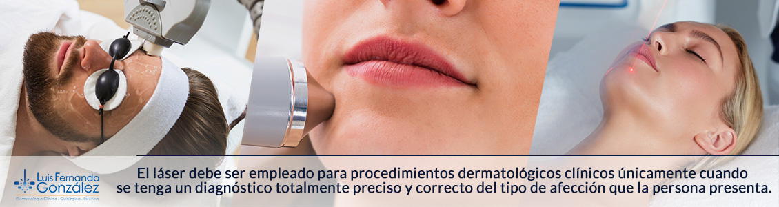Hay cierto tipo de manchas en la piel que pueden agravarse seriamente si son tratadas con esta tecnología y esto puede llegar a ser seriamente peligroso Tecnología Laser Personas Cara
