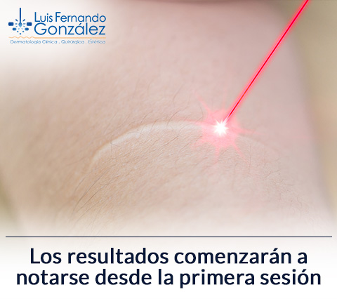 Laser CO2 en Piel