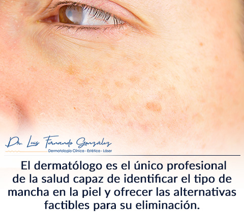 Dermatologo para Eliminacin de Manchas en la Piel