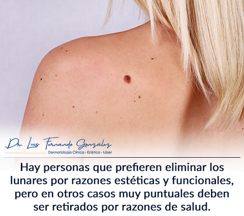 El Dr. Luis Fernando Gonzalez es Especialista en Resscción de Lunares Resección de Lunares por Dermatólogo en Bogotá