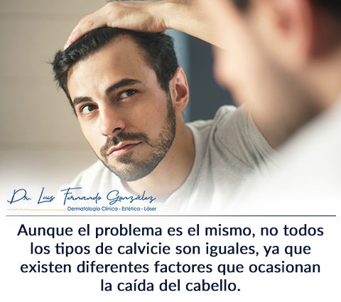 Los Tipos de Calvicie Pueden ser Tratados por un Dermatólogo Tipos de Calvicie