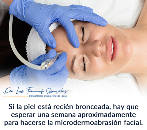 Mujer se hace una Microdermoabrasin Facial.