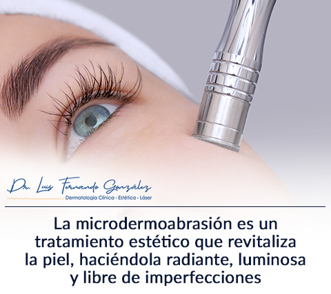 Microdermoabrasin Facial en una Mujer Joven.