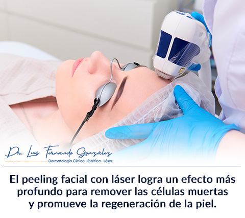 El peeling facial es una solución efectiva que devolverá a la piel el brillo perdido. Mujer se hace un Peeling Facial.