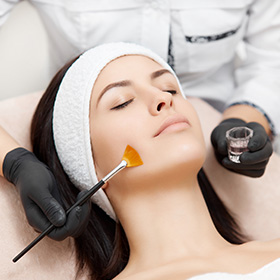 Peeling Facial en una Mujer Joven.