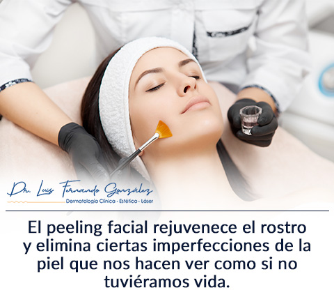 El peeling facial te ayuda a remover las impurezas de tu rostro. Peeling Facial en una Mujer Joven.