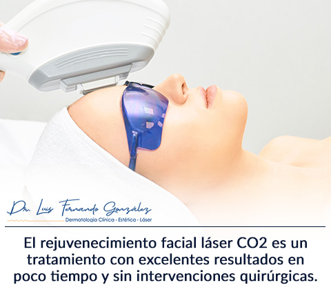 Mujer Descubre Todo Sobre el Rejuvenecimiento Facial con Lser CO2.