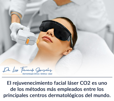 Mujer Conoce Todo Sobre el Rejuvenecimiento Facial con Lser CO2.